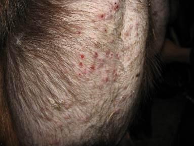 Slika 8. Stafilokokni drematitis